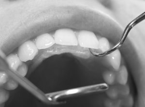 Periodontal dental examination