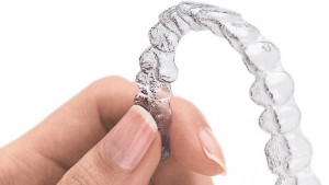 Photo of an Invisalign Dentist Holding Trays