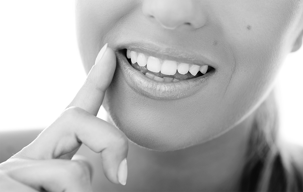 Need Teeth Whitening in Indianapolis? We have you covered.