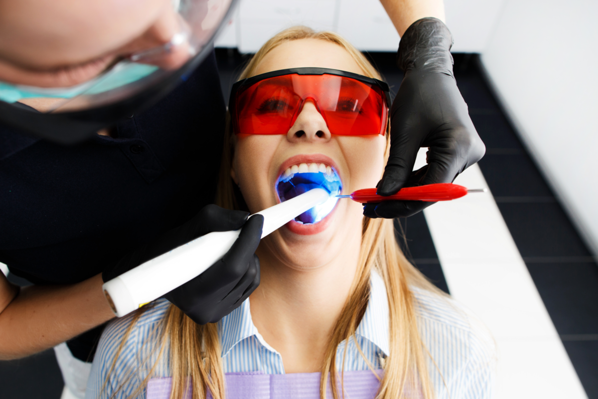 Need Teeth Whitening in Indianapolis? We have you covered.